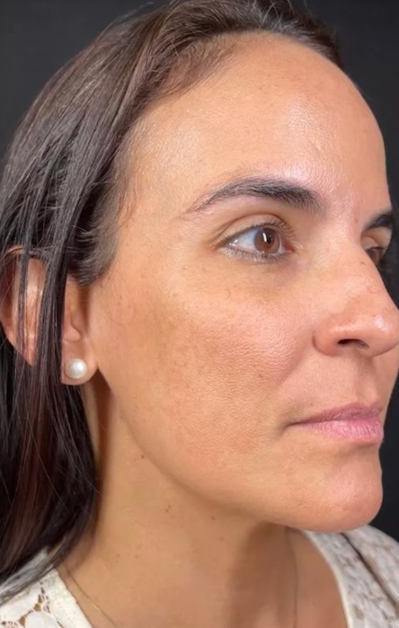 Depois - Juliana Santos