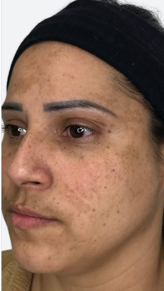 Antes - Maria Silva